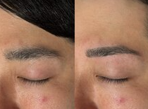 モテ眉スタイリングの施術事例 2